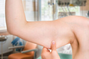 sarcopenia