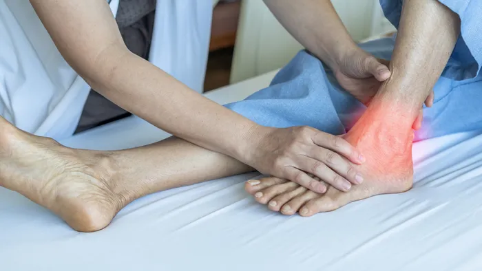 Tibialis Posterior Tendon Dysfunction