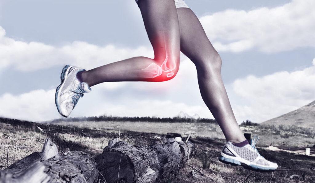 Runner's Knee