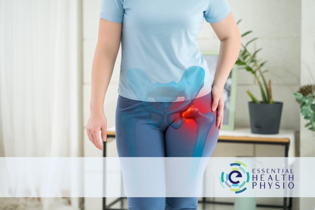 Birkdale Physiotherapy for Hip Pain | Essential Health Physio