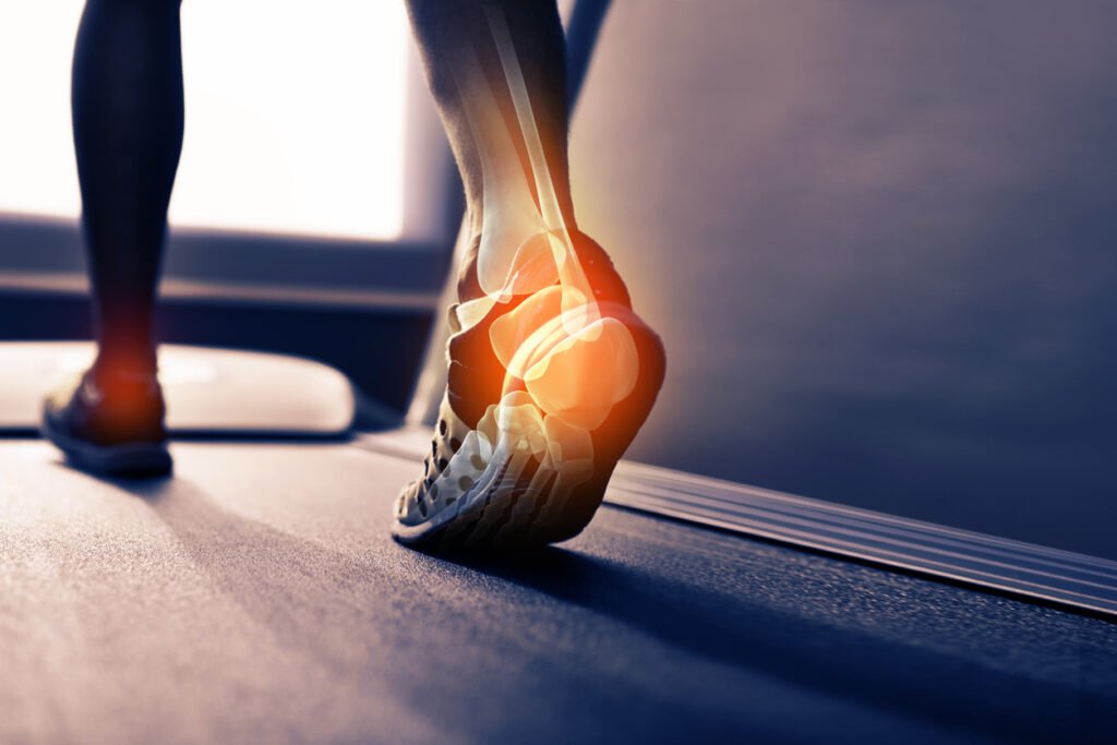 achilles-tendon-injuries