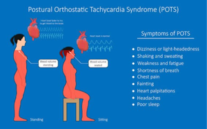 Ehlers Danlos Syndrome (EDS)